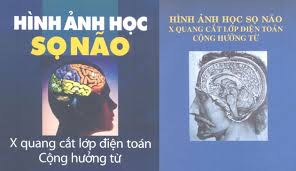 tải xuống.jpg