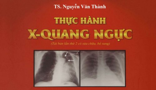 feat-img_Thuc-hanh-X-quang-nguc-Nguyen-Van-Thanh-850x491.jpg